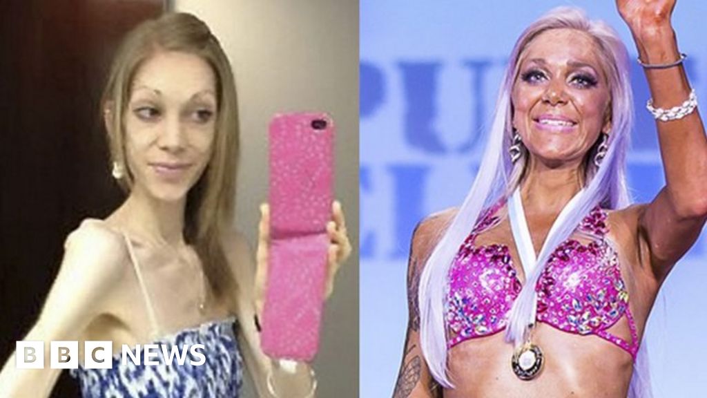 Woman Explains Her Journey From Anorexia To Bodybuilding Champ Bbc News 