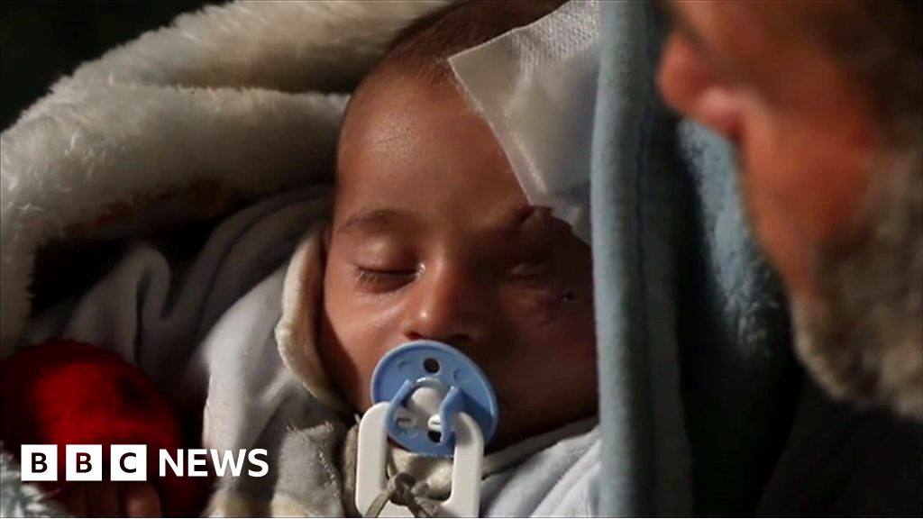 Race To Rescue Injured Syrian Baby - BBC News