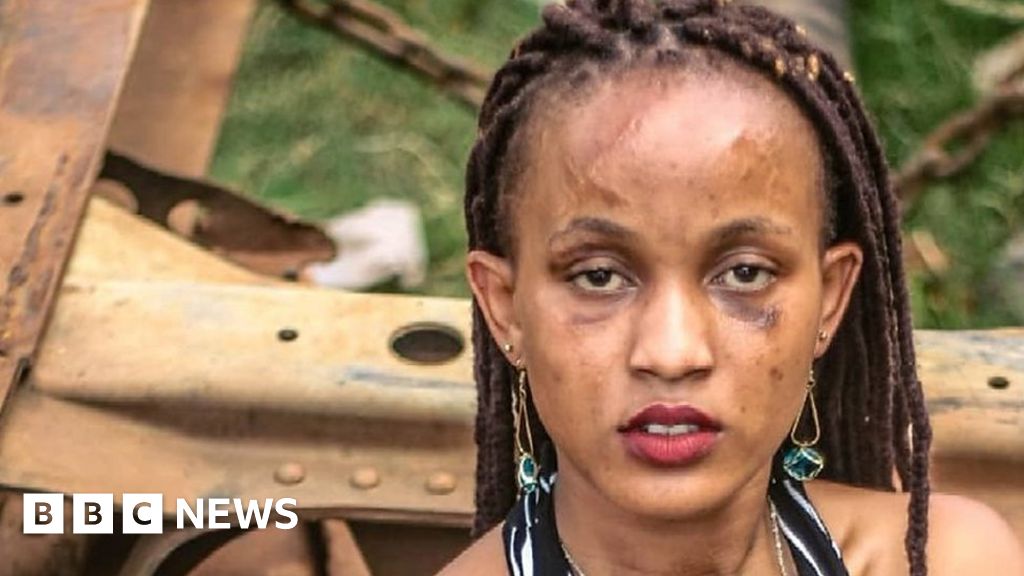 Kenyan Model I Wont Wear Make Up To Hide My Scars Bbc News 2110