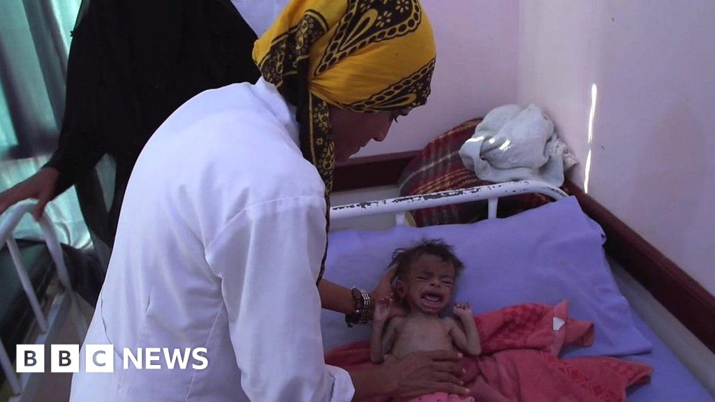 Yemen: The doctor on the front line after years of war
