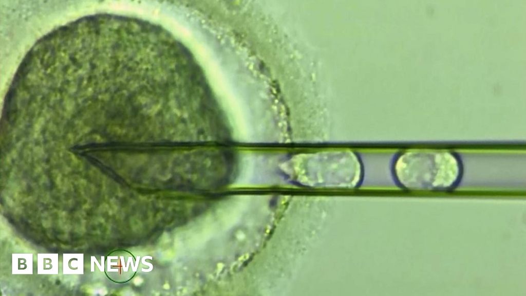 Scientists Stunned Three Parent Ivf Babies Are Surprisingly Healthy - 3lvsdng