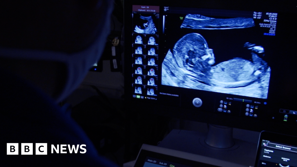 Private baby scans poor practice' BBC News