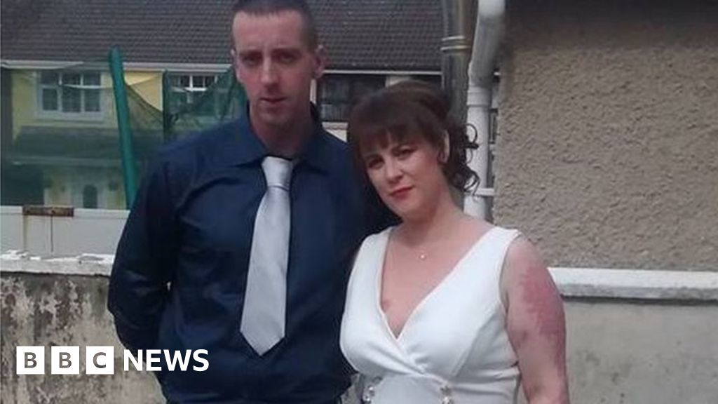 Woman With Psoriasis Faced Online Abuse By Some Quiz Shop Staff