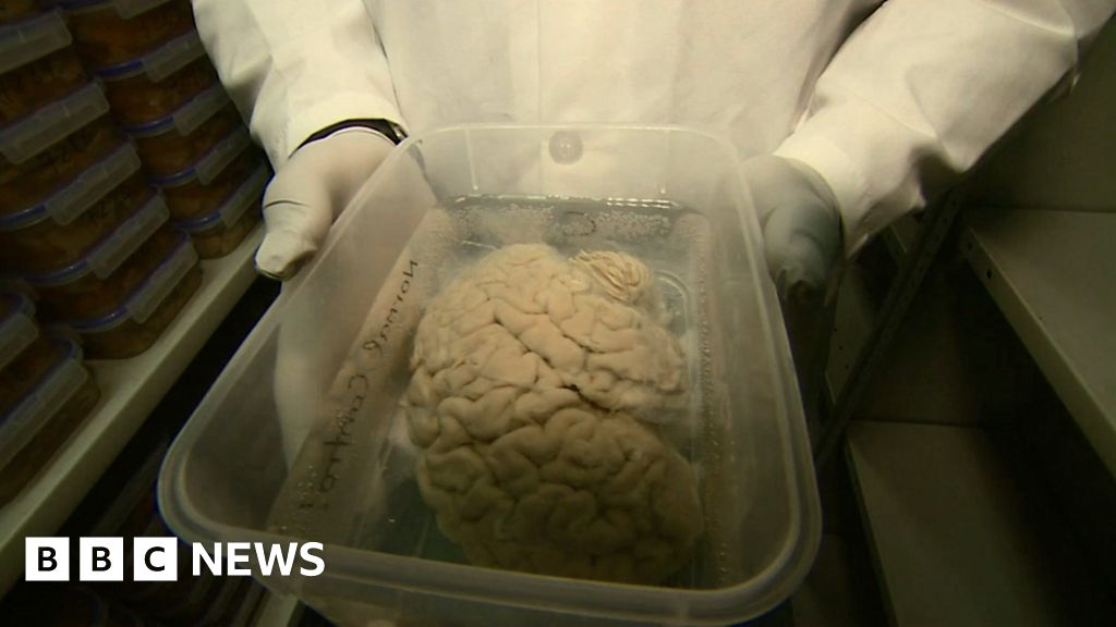 Scientists Appeal For More People To Donate Their Brains Bbc News