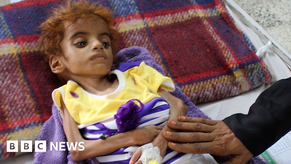 Yemen Crisis Half Of Population Facing Pre Famine Conditions Bbc News