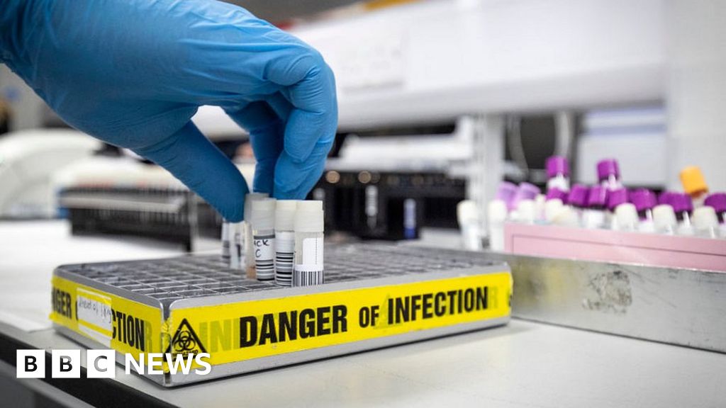 Coronavirus: Can the UK have the 100,000 tests per day?