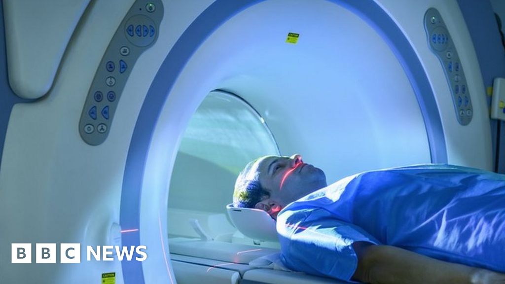 Long Covid: MRI scans reveal new clues to symptoms