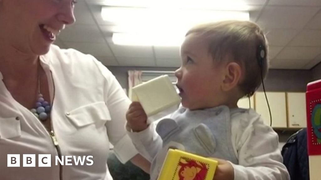 Cochlear Implant Deaf Oneyearold Hears Sound For The First Time