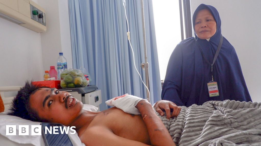 Erupția Muntelui Marapi: Un supraviețuitor povestește BBC despre încercarea sa de la spital