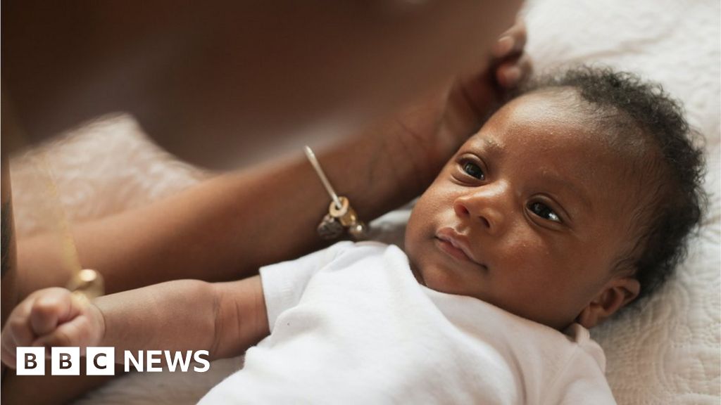 Concerns over focus on skin colour in newborn checks
