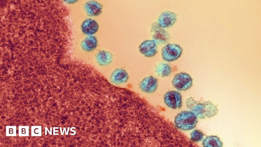 Hiv Flushed Out By Cancer Drug Bbc News 