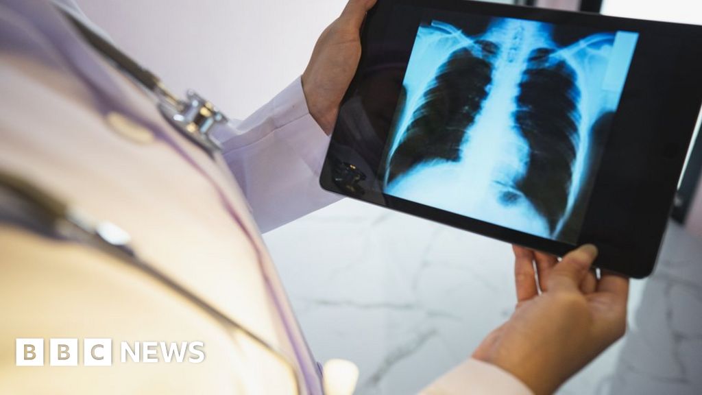 Covid19 Vaccination plea after cancer surgeries cancelled