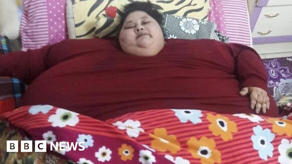 India Doctor To Operate On 500kg Egyptian Woman Bbc News 