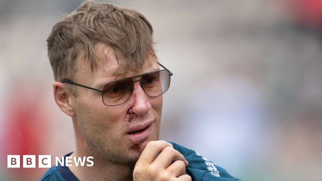 Freddie Flintoff accepts compensation for Top Gear accident