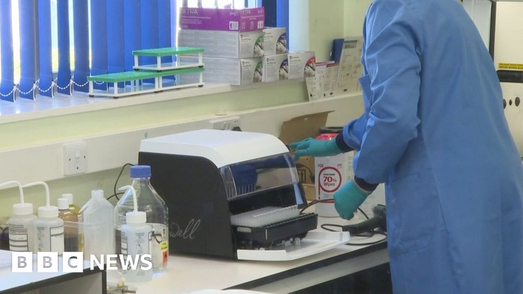 Coronavirus cases in Guernsey rise to 329