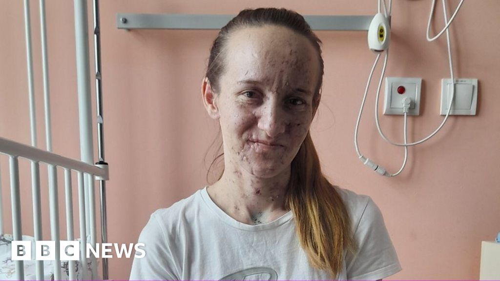 Ukraine war: Mum describes bomb crashing into her family home