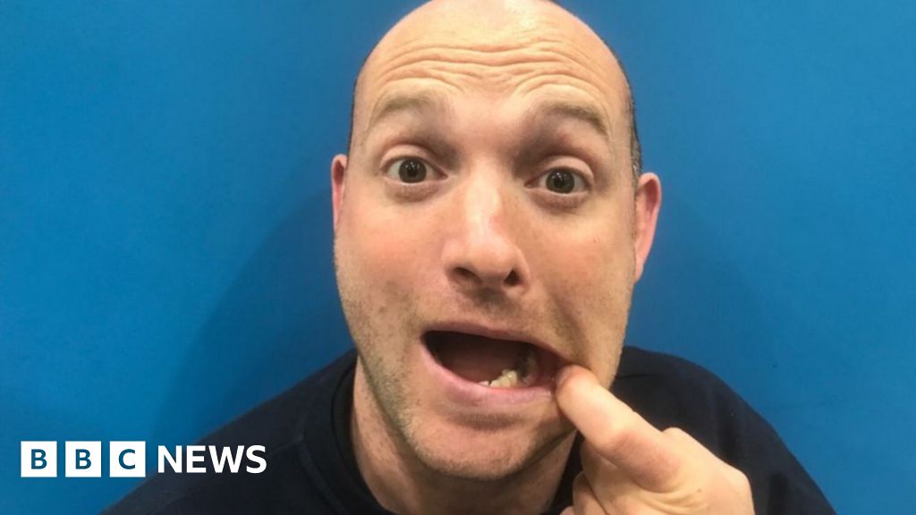 Coronavirus: Man refused appointment pulls out tooth at home ...