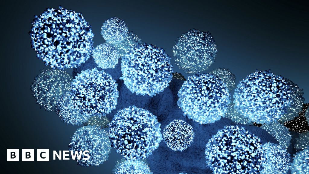 Hiv Patient Zero Cleared By Science Bbc News