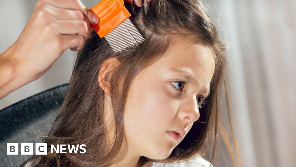 Itchy Business The Growth Of Head Lice Removal Firms Bbc News