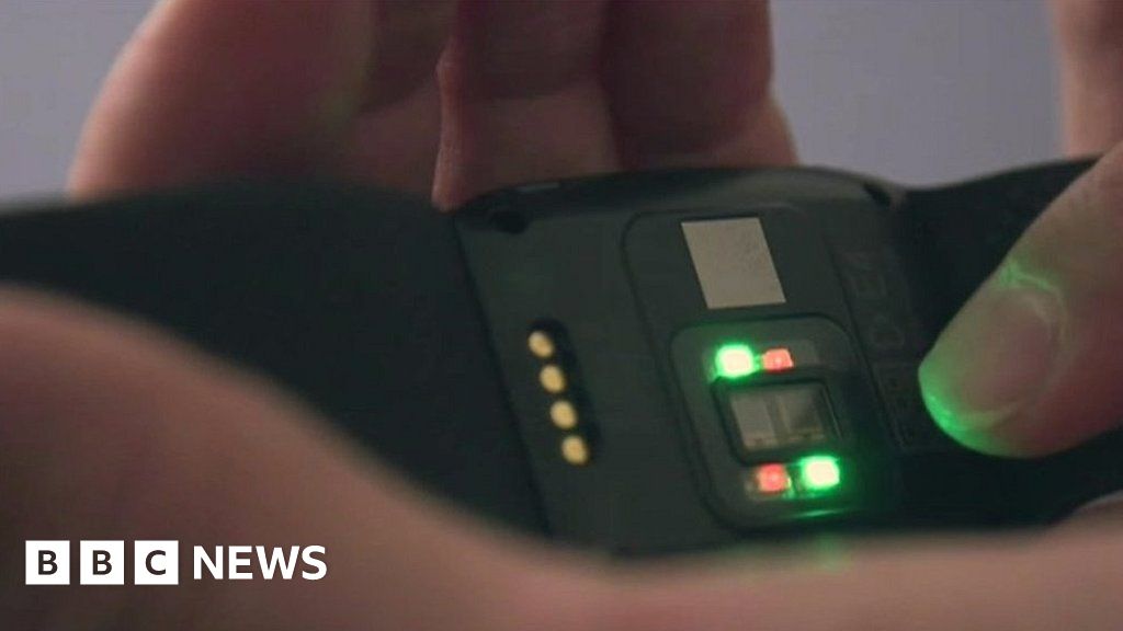 The watch that helps manage severe autism