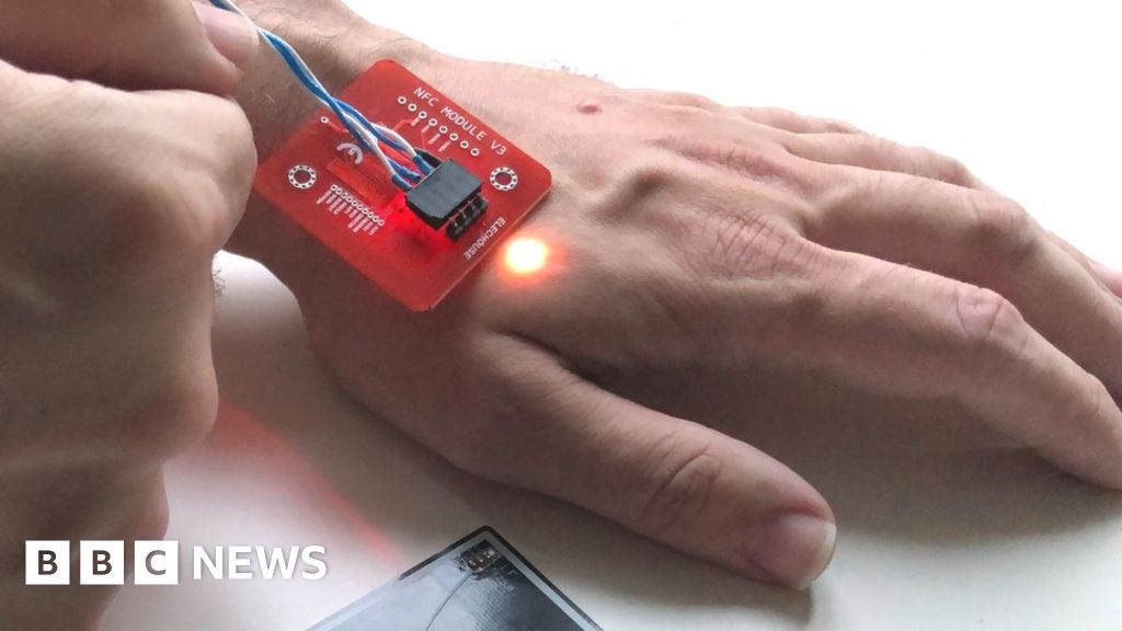 The microchip implants that let you pay with your hand