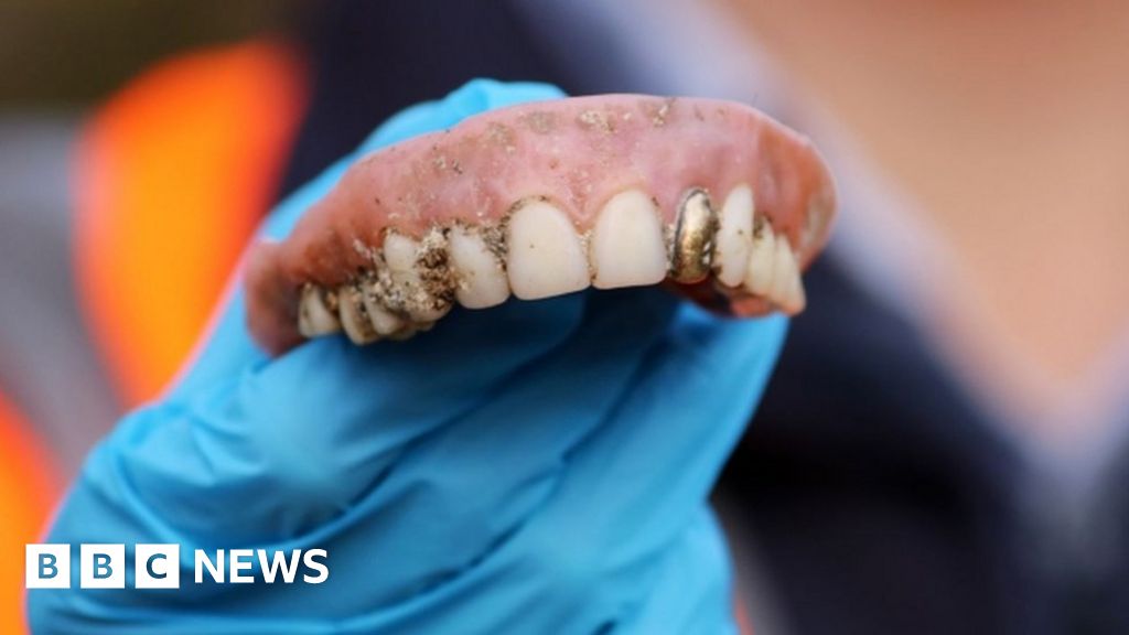 Dentures with gold false tooth flushed down toilet in Bristol BBC News