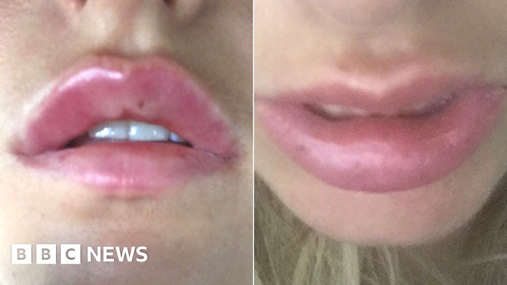 How Safe Is The Cosmetic Surgery Boom Bbc News