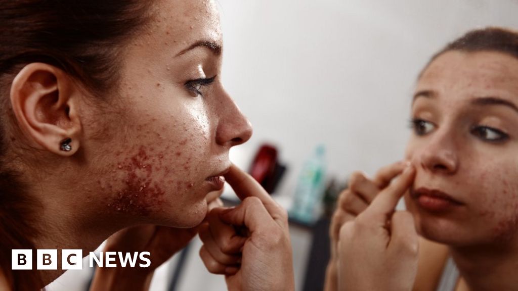 How to get accutane uk