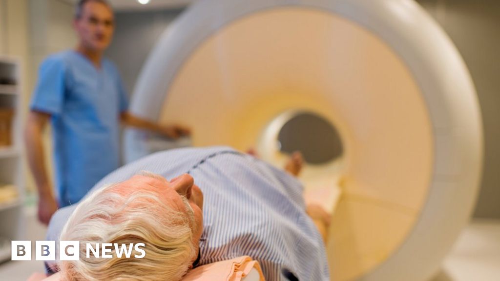 MRI scan could screen men for prostate cancer