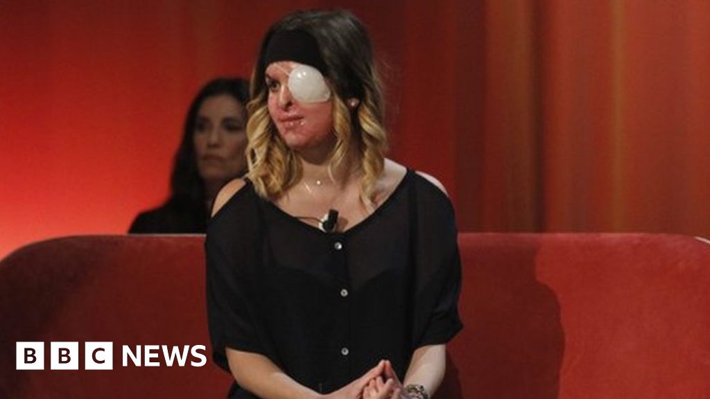 La modella italiana Gessica Notaro, vittima di un attacco con l'acido, affronta uno show televisivo