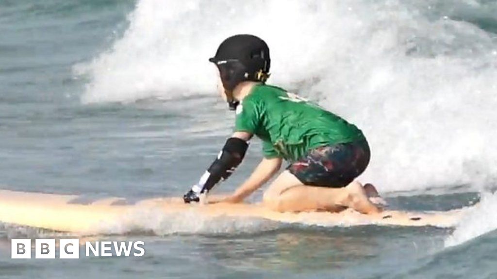 New surfing aid for prosthetic arm tested in Bristol