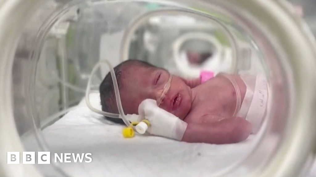 Un bébé né par césarienne d’urgence et sa mère tuée à Gaza