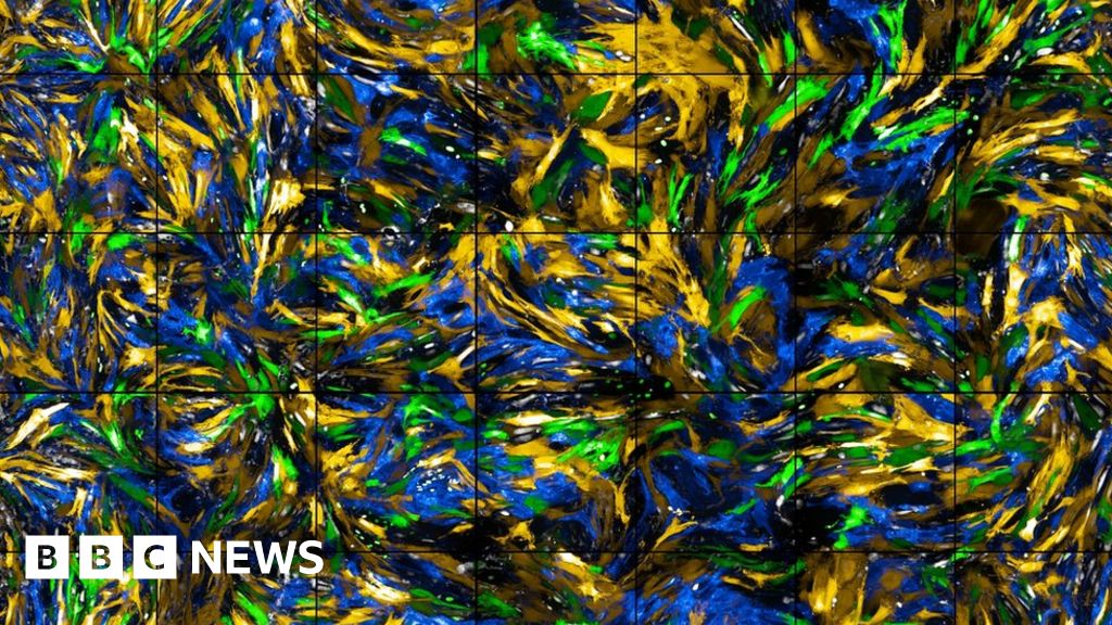 A colourful sea of blood vessel cells wins science image competition