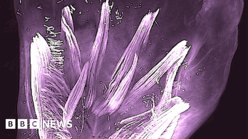 Babies in the womb have lizard-like hand muscles - BBC News