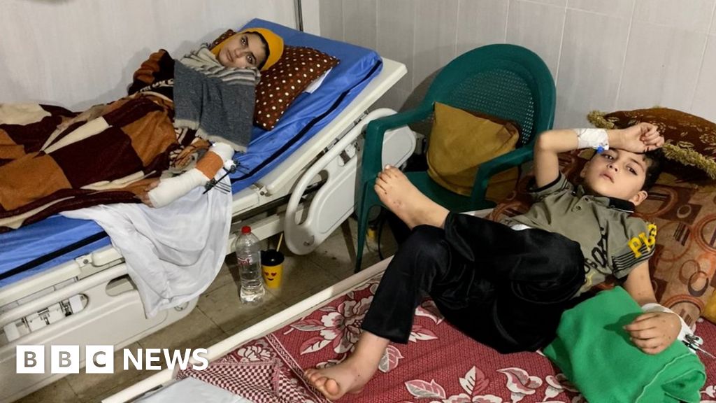 Децата в болница Ал Акса не мислят за мъртвите в Газа
