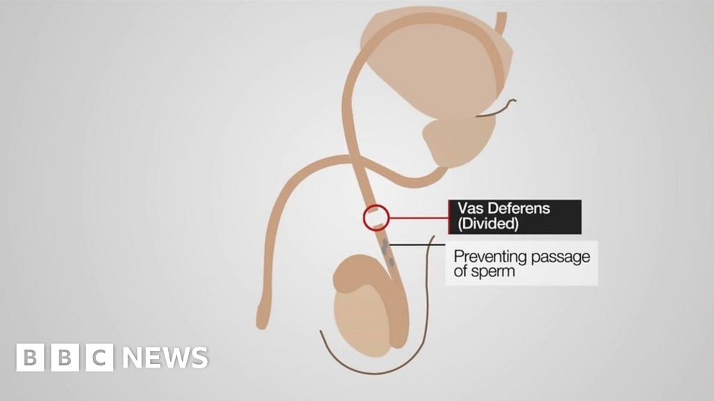 How A Vasectomy Works Bbc News