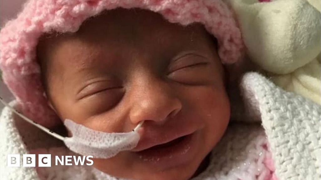 The tiny premature baby, who fought with coronavirus