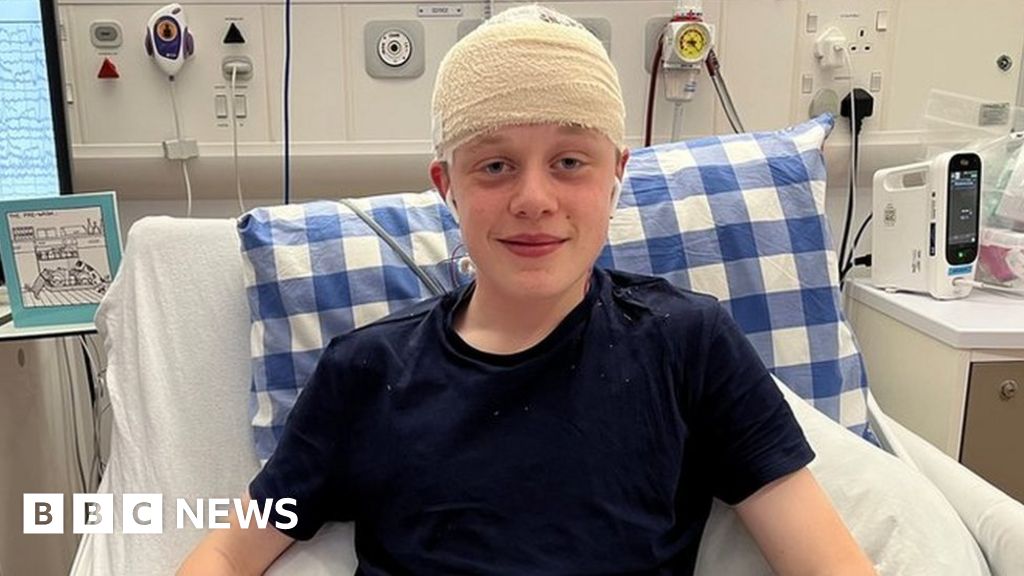 Brain Surgery Teen To Have First Seizure Free Christmas Otherweb