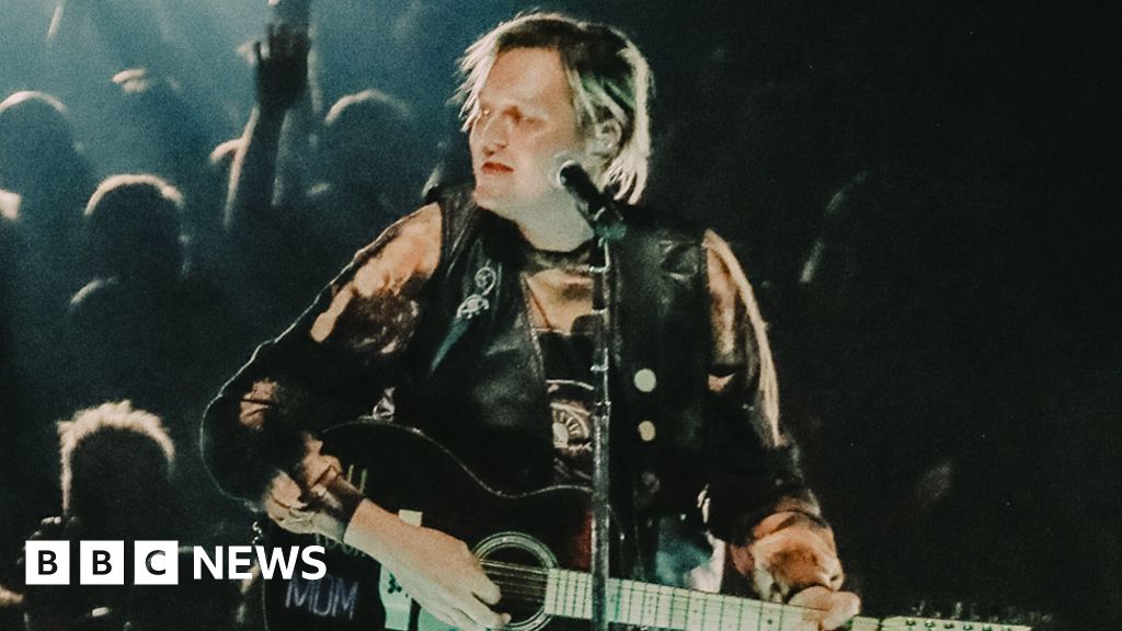 Arcade Fire kick off world tour in Dublin after Win Butler abuse allegations