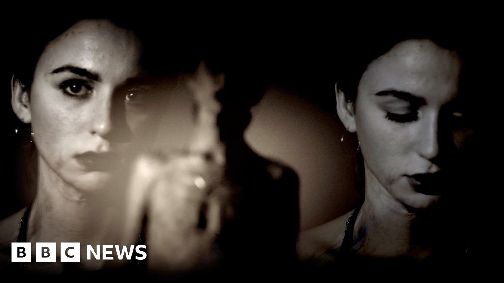 Life after burns: ‘I use my scars and pain to help others’ - BBC News