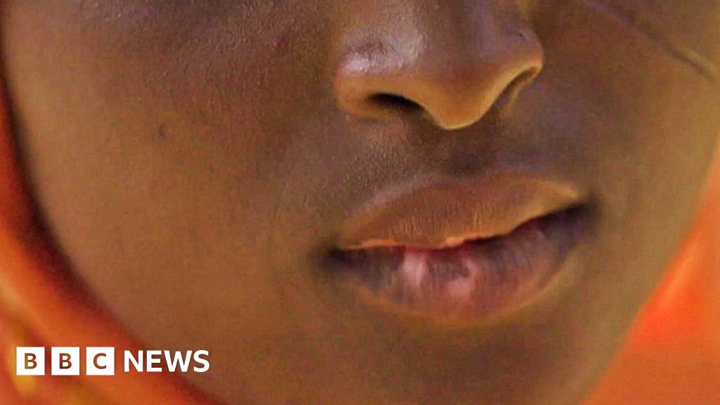 I scarred my six children by using skin-lightening creams