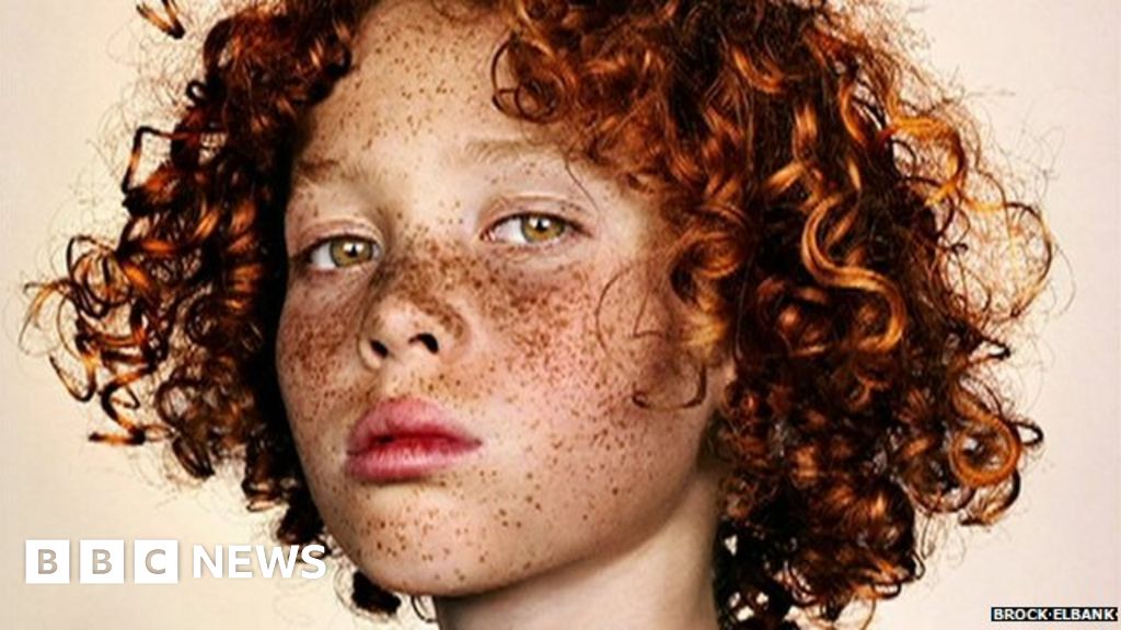 Celebrating Faces Full Of Freckles Bbc News 6884