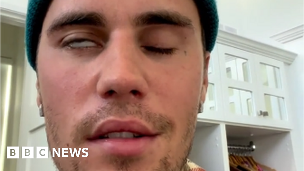 Justin Bieber Reveals Facial Paralysis After Shows Cancelled c News