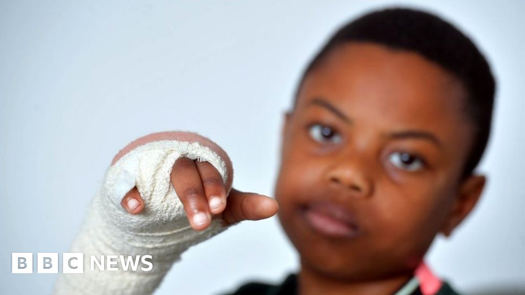 Abertillery boy, 11, loses finger allegedly fleeing bullies