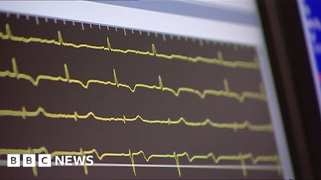 Warning For Women Over Irregular Heartbeat Bbc News