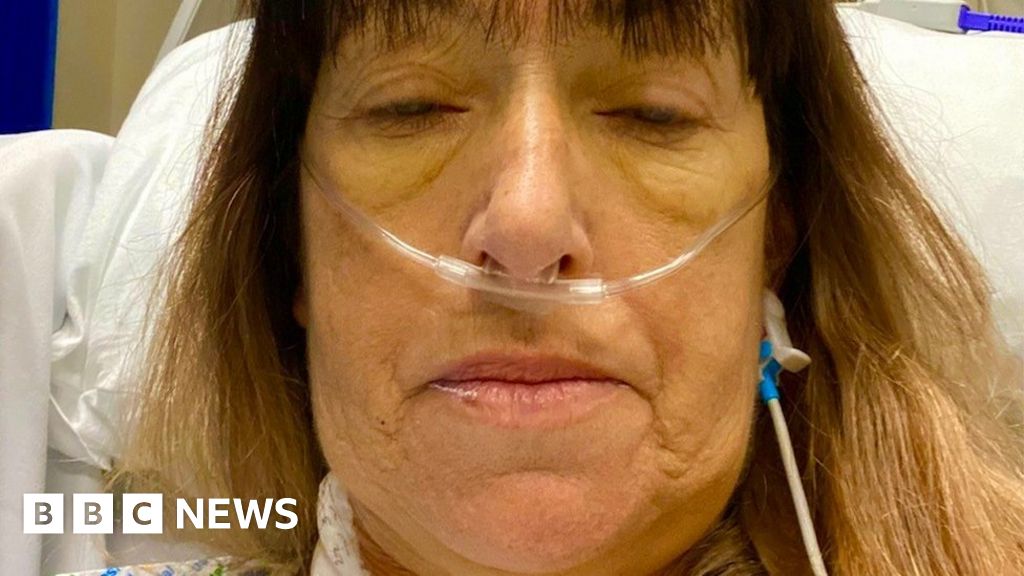 'I turned Marge Simpson yellow - it was so scary'