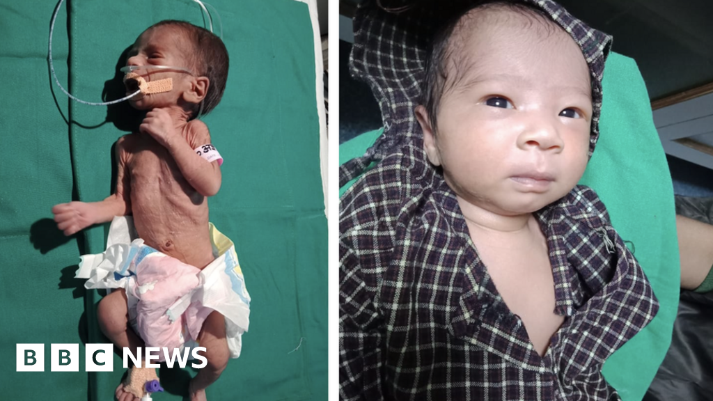 India newborn found alive in shallow grave now thriving