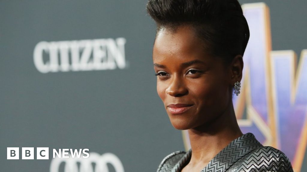 Letitia Wright treated for injuries after Black Panther 2 accident