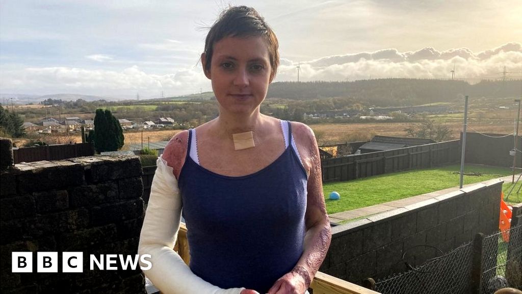 Seven Sisters: Explosion victim looks forward new home 