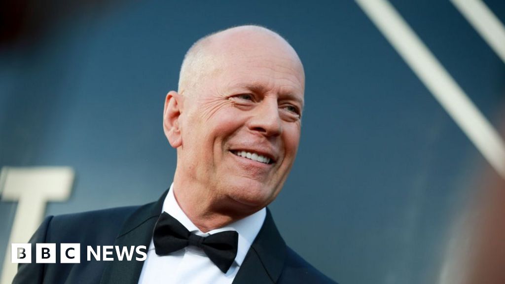 Bruce Willis has frontotemporal dementia – what is it?